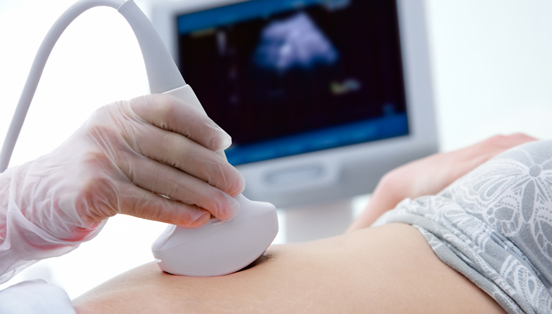 technician performing a pregnancy ultrasound