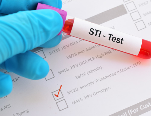 sti test vial and paperwork