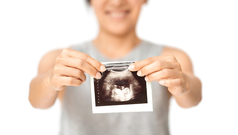 woman showing pregnancy ultrasound to the camera